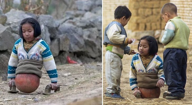  The Amazing Story of a Girl With No Legs That Moved On a Ball