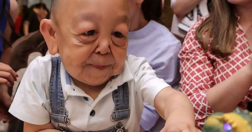  The Real Benjamin Button: A Six-Year-Old Boy with an Old Man’s Body