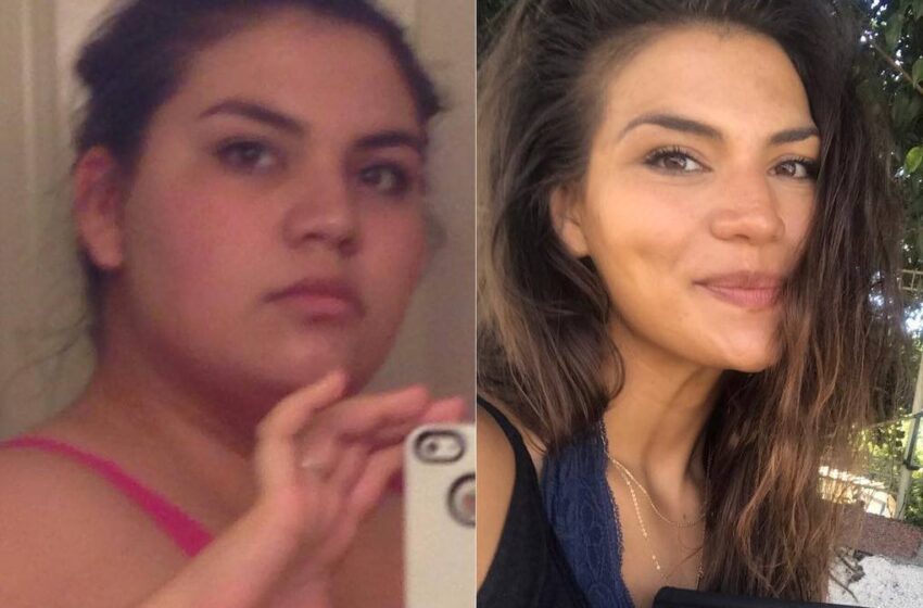  4 Years Ago This Girl Weighed 140 kg and You Just Wouldn’t Recognize Her in the Old Photos
