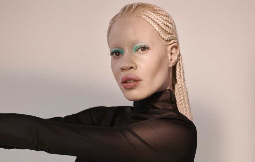  African-American Albino Woman With an Interesting Appearance Conquers Modeling Heights